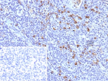 IHC staining of FFPE human tonsil tissue with IGLV1-51 antibody (clone IGLC1/9475). Inset: PBS used in place of primary Ab (secondary Ab negative control). HIER: boil tissue sections in pH 9 10mM Tris with 1mM EDTA for 20 min and allow to cool before testing.