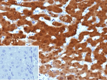 IHC staining of FFPE human hepatocellular carcinoma tissue with Arginase 1 antibody (clone ARG1/9448). Inset: PBS used in place of primary Ab (secondary Ab negative control). HIER: boil tissue sections in pH 9 10mM Tris with 1mM EDTA for 20 min and allow to cool before testing.