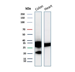Western blot testing of human colon and heart tissue lysate with recombinant Galectin 3 antibody (clone LGALS3/13208R). Predicted molecular weight ~26 kDa.