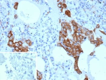 IHC staining of FFPE human lung tissue with MRC1 antibody (clone MRC1/9454). Inset: PBS used in place of primary Ab (secondary Ab negative control). HIER: boil tissue sections in pH 9 10mM Tris with 1mM EDTA for 20 min and allow to cool before testing.