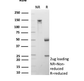 SDS-PAGE analysis of purified, BSA-free CD206 antibody (clone MRC1/9456) as confirmation of integrity and purity.