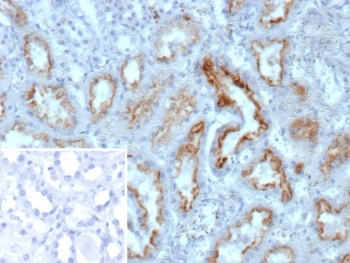 IHC staining of FFPE human kidney tissue with Nucleoside diphosphate kinase B antibody (clone NME2/12061). Inset: PBS used in place of primary Ab (secondary Ab negative control). HIER: boil tissue sections in pH 9 10mM Tris with 1mM EDTA for 20 min and allow to cool before testing.