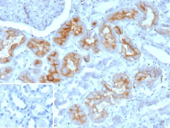 IHC staining of FFPE human kidney tissue with PD-Ibeta antibody (clone ENPP3/9891). Inset: PBS used in place of primary Ab (secondary Ab negative control). HIER: boil tissue sections in pH 9 10mM Tris with 1mM EDTA for 20 min and allow to cool before testing.