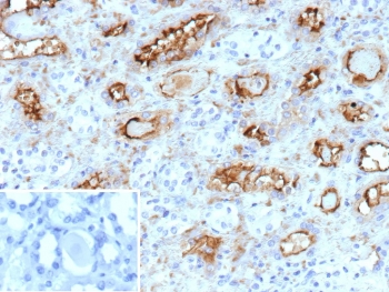 IHC staining of FFPE human kidney tissue with PD-Ibeta antibody (clone ENPP3/9892). Inset: PBS used in place of primary Ab (secondary Ab negative control). HIER: boil tissue sections in pH 9 10mM Tris with 1mM EDTA for 20 min and allow to cool before testing.