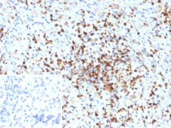 IHC staining of FFPE human spleen tissue with S100A4 antibody (clone S100A4/6797). Inset: PBS used in place of primary Ab (secondary Ab negative control). HIER: boil tissue sections in pH 9 10mM Tris with 1mM EDTA for 20 min and allow to cool before testing.