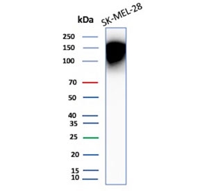 Western blot testing of human SK-MEL-28 cell lysate with CD66a antibody (clone CEACAM1/12661). Predicted molecular weight ~58 kDa but may be observed at higher molecular weights due to heavy glycosylation.