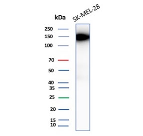 Western blot testing of human SK-MEL-28 cell lysate with Biliary glycoprotein 1 antibody (clone CEACAM1/12665). Predicted molecular weight ~58 kDa but may be observed at higher molecular weights due to heavy glycosylation.
