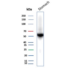 Western blot testing of human stomach tissue lysate with recombinant CA9 antibody (clone rCA9/9937). Predicted molecular weight: 50-55 kDa but may be observed at higher molecular weights due to glycosylation.