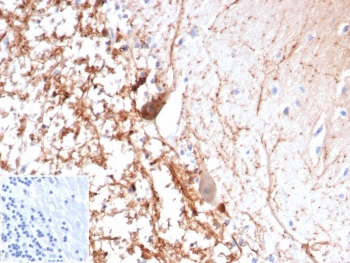 IHC staining of FFPE human brain tissue with recombinant Calretinin antibody (clone CALB2/4688R). Inset: PBS used in place of primary Ab (secondary Ab negative control). HIER: boil tissue sections in pH 9 10mM Tris with 1mM EDTA for 20 min and allow to cool before testing.