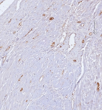 IHC staining of FFPE human uterus tissue with CD34 antibody (clone CD34/7717). HIER: boil tissue sections in pH 9 10mM Tris with 1mM EDTA for 20 min and allow to cool before testing.
