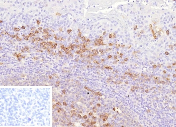 IHC staining of FFPE human tonsil tissue with ADP-ribosyl cyclase 1 antibody (clone CD38/9332). Inset: PBS used in place of primary Ab (secondary Ab negative control). HIER: boil tissue sections in pH 9 10mM Tris with 1mM EDTA for 20 min and allow to cool before testing.