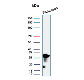 Western blot analysis of CELA3A expression. Human pancreas tissue lysate was analyzed by SDS-PAGE and immunoblotting using a CELA3A/Chymotrypsin like elastase 3A antibody (clone CELA3A/12553). A prominent band is detected at the predicted molecular weight (~29 kDa) corresponding to Chymotrypsin like elastase 3A, with an additional lower molecular weight band consistent with proteolytically processed forms commonly observed for pancreatic digestive enzymes.