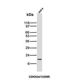 Western blot testing of human HeLa cell lysate using CDKN2A/p16INK4a antibody (clone CDKN2A/13309R).