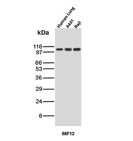 Western blot analysis of human lung tissue, A431 cells, and Raji cells using HSPH1 antibody (clone r58F12). A prominent band is observed at the expected apparent molecular weight for Heat shock protein 105 kDa across all samples analyzed. Although the predicted molecular weight of HSPH1 is approximately 97 kDa based on sequence analysis, the protein commonly migrates at a higher apparent molecular weight on SDS-PAGE, consistent with its known biochemical properties and chaperone structure.
