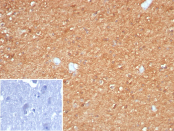 Immunohistochemistry analysis of formalin-fixed, paraffin-embedded human brain tissue using CKB antibody (clone CKBB/8295R). Diffuse cytoplasmic staining is observed throughout the neuropil, with signal present in neuronal cell bodies and surrounding parenchyma. Individual nuclei show minimal staining, and background signal in the section is low. Nuclei are counterstained in blue. Inset shows PBS substituted for the primary antibody as a secondary-only negative control. Heat-induced antigen retrieval was performed by heating tissue sections in 10 mM Tris with 1 mM EDTA, pH 9.0, for 45 minutes at 95oC, followed by cooling at room temperature for 20 minutes.