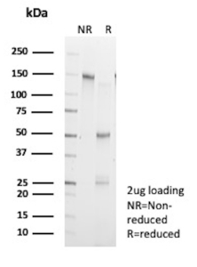 SDS-PAGE Analysis of Purified CKM/Creatine kinase M-type antibody (clone CKMM/13033R). Confirmation of Purity and Integrity of Antibody.
