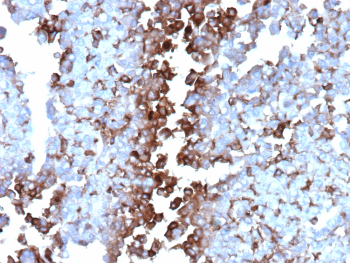 Immunohistochemistry analysis of formalin-fixed, paraffin-embedded human adrenal gland tissue using CLU/Clusterin antibody (clone CLU/4737). Predominantly cytoplasmic staining is observed in adrenal cortical cells, with variable intensity across cell populations and minimal background staining in surrounding stromal areas. Nuclei are counterstained in blue. Heat-induced antigen retrieval was performed by heating tissue sections in 10 mM Tris with 1 mM EDTA, pH 9.0, for 45 minutes at 95oC, followed by cooling at room temperature for 20 minutes.