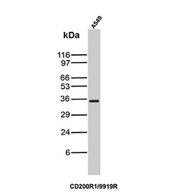 Western blot analysis of human A549 cell lysate using recombinant OX2R/OX-2 receptor antibody (clone CD200R1/9919R). Predicted molecular weight: 19-39 kDa but may be observed at higher molecular weights due to glycosylation.