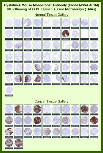 Immunohistochemistry tissue microarray analysis of Cystatin A expression. CSTA/Cystatin A antibody (clone MSVA-461M) was evaluated by immunohistochemistry on formalin-fixed, paraffin-embedded human tissue microarrays encompassing a broad range of normal and cancer tissues. Staining demonstrates cytoplasmic labeling patterns in epithelial compartments consistent with known Cystatin A expression profiles, with variable intensity across tissue types. Overall staining distribution and relative expression patterns are concordant with publicly available expression data reported by the Human Protein Atlas, supporting the biological relevance of the observed immunoreactivity.