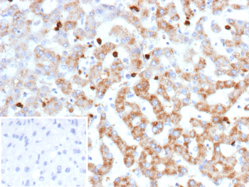 Immunohistochemistry analysis of Cathepsin G in human liver tissue. Formalin-fixed, paraffin-embedded human liver tissue was stained using recombinant CTSG/Cathepsin G antibody (clone r19C3), showing cytoplasmic staining in scattered hepatic immune-associated cells consistent with known CTSG expression patterns. Heat-induced epitope retrieval was performed by heating tissue sections in 10 mM Tris with 1 mM EDTA, pH 9.0, at 95oC for 45 minutes, followed by cooling at room temperature for 20 minutes. Inset shows PBS substituted for the primary antibody as a secondary-only negative control.