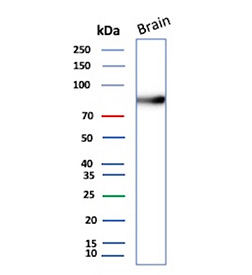 Western blot analysis of human brain tissue lysate using recombinant ENG/Endoglin antibody (clone r4G11). This glycosylated protein is observed at molecular weight: 70-90 kDa (monomer) and 140-180 kDa (dimer).