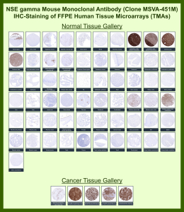 Immunohistochemistry tissue microarray analysis of Gamma-enolase expression. Gamma-enolase Mouse Monoclonal Antibody (clone MSVA-451M) was evaluated by immunohistochemistry on formalin-fixed, paraffin-embedded human tissue microarrays encompassing a wide panel of normal and cancer tissues. Staining demonstrates strong cytoplasmic immunoreactivity in neuronal and neuroendocrine tissues, including cerebellum and cerebral cortex, with limited staining in non-neural tissues, consistent with the known expression profile of Gamma-enolase. Cancer tissues show variable positivity in tumors with neuroendocrine or neuronal differentiation. Overall staining distribution and relative expression patterns are concordant with publicly available expression data reported by the Human Protein Atlas, supporting the biological relevance of the observed immunoreactivity.