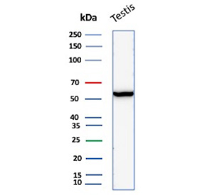 Western blot analysis of human testis tissue lysate using Estrogen Receptor Beta 2 Mouse Monoclonal Antibody (ESR2/6661).