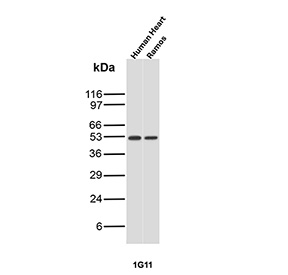 Western blot testing of human heart and human Ramos lysates using Transcription Factor ETS1 antibody (clone r1G11). Predicted molecular weight ~51 kDa.