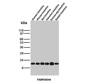 Western blot analysis of FABP2 in intestinal tissues. Western blot analysis was performed using tissue lysates from human intestine, mouse intestine, rat intestine, hamster intestine, guinea pig intestine, and rabbit intestine probed with FABP2/Fatty acid binding protein 2 antibody (clone FABP2/6344). A distinct immunoreactive band is observed at the predicted molecular weight of FABP2 across all intestinal samples, consistent with conserved expression of fatty acid binding protein 2 in absorptive intestinal epithelium. Predicted molecular weight ~15 kDa.