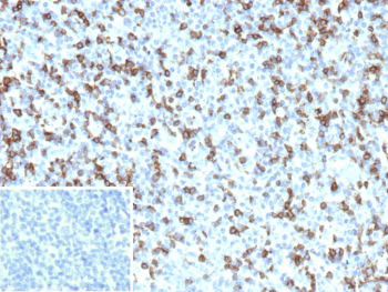 Immunohistochemistry analysis of FCGR1A (CD64). Formalin-fixed, paraffin-embedded human tonsil tissue stained with FCGR1A/High affinity immunoglobulin gamma Fc receptor I antibody (clone FCGR1A/7499). Brown chromogenic signal indicates FCGR1A-positive cells, with membranous and cytoplasmic brown staining observed in immune cells within the tonsillar tissue. Inset shows PBS used in place of primary antibody as a secondary-only negative control. Heat-induced epitope retrieval was performed by heating tissue sections in 10mM Tris with 1mM EDTA, pH 9.0, for 45 minutes at 95oC, followed by cooling at room temperature for 20 minutes.