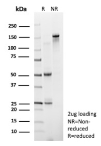 SDS-PAGE Analysis of Purified D-Dimer / Fibrinogen Gamma Recombinant Rabbit Monoclonal Antibody (FGG/13043R). Confirmation of Purity and Integrity of Antibody.