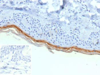 Formalin-fixed, paraffin-embedded human skin stained with recombinant FLG/Filaggrin antibody (clone r15C10). Brown chromogenic signal is localized to the superficial epidermal layers, consistent with Filaggrin-positive keratinocytes in the stratum granulosum and stratum corneum. Inset shows PBS substituted for the primary antibody as a secondary-only negative control. Staining of formalin-fixed tissues requires heating tissue sections in 10mM Tris with 1mM EDTA, pH 9.0, for 45 min at 95oC followed by cooling at RT for 20 minutes.