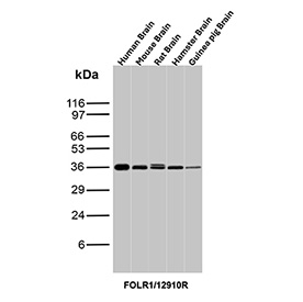 Western blot analysis of Folate receptor alpha expression in brain tissue lysates. Brain tissue lysates from human, mouse, rat, hamster, and guinea pig were analyzed by western blot using FOLR1/Folate receptor alpha antibody (clone FOLR1/12910R). A single immunoreactive band is detected above the predicted molecular weight. Although the predicted molecular weight of Folate receptor alpha is approximately 30 kDa based on sequence analysis, the protein is extensively glycosylated, resulting in a higher apparent molecular weight on SDS-PAGE.