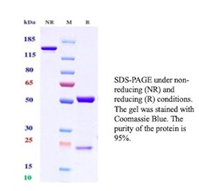 SDS-PAGE analysis of recombinant FOLR1 antibody. Recombinant FOLR1 antibody (clone FOLR1/13425R) was analyzed by SDS-PAGE under non-reducing (NR) and reducing (R) conditions and visualized by Coomassie Blue staining. Under non-reducing conditions, the antibody migrates predominantly as a single band corresponding to intact immunoglobulin, while reducing conditions resolve bands consistent with antibody heavy and light chains. The gel demonstrates high sample purity and intact antibody structure.