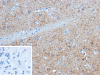 Formalin-fixed, paraffin-embedded human brain stained with GAD1/Glutamate decarboxylase 1 antibody (clone BICCN-GAD67-1A6). Diffuse cytoplasmic brown chromogenic staining is observed in neuronal cell bodies and processes, consistent with GABAergic neuron labeling, while surrounding nuclei are counterstained blue. Inset shows a PBS-only negative control processed without primary antibody, demonstrating minimal non-specific background staining.