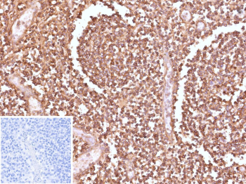 Formalin-fixed, paraffin-embedded human tonsil stained with HLA-E/HLA class I histocompatibility antigen E antibody (clone HLAE/9467). Lymphoid cells within tonsillar follicles and interfollicular regions show membranous and cytoplasmic brown chromogenic staining, consistent with HLA-E expression in immune cell populations, while nuclei are counterstained blue. Inset shows a PBS-only negative control processed without primary antibody, demonstrating minimal non-specific background staining.