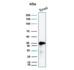 Western blot analysis of human tonsil tissue lysate probed with MHC-E/MHC class I antigen E antibody (clone HLAE/13125). A distinct band is detected near the predicted molecular weight of approximately 40-45 kDa, consistent with MHC class I antigen E heavy chain expression in lymphoid tissue. The observed band pattern supports specific detection of MHC-E in immune cell-enriched tissue lysates.