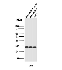 Western blot analysis of human skeletal muscle tissue lysate, human skin tissue lysate, and human HeLa cell lysate probed with recombinant HSPB1/Heat shock protein beta 1 antibody (clone r2B4). A single band is detected at the predicted molecular weight of approximately 27 kDa, consistent with Heat shock protein beta 1 expression across muscle, epithelial tissue, and cultured cells. The observed band pattern supports specific detection of HSPB1 in multiple human sample types.