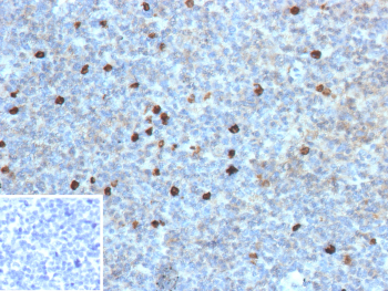 Formalin-fixed, paraffin-embedded human tonsil stained with recombinant IGHG4/Immunoglobulin heavy constant gamma 4 antibody (clone IGHG4/13367R). Scattered plasma cells within the tonsillar tissue show cytoplasmic brown chromogenic staining consistent with Immunoglobulin heavy constant gamma 4 expression, while surrounding lymphoid cells are largely negative. Nuclei are counterstained blue. Inset shows a PBS-only negative control processed without primary antibody, demonstrating minimal non-specific background staining.