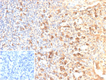 Immunohistochemistry analysis of CD25 / IL2RA antibody (clone rIL2RA/12624) in human tonsil. Formalin-fixed, paraffin-embedded human tonsil tissue shows membranous and cytoplasmic brown chromogenic staining in scattered lymphoid cells, consistent with IL2RA-positive immune cell populations. Inset shows a PBS-only negative control processed without primary antibody, demonstrating minimal non-specific background staining.