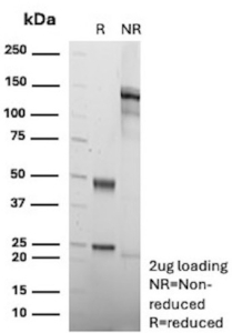 SDS-PAGE Analysis of purified recombinant FAS/Fas cell surface death receptor antibody (rGM30). Confirmation of Purity and Integrity of Antibody.