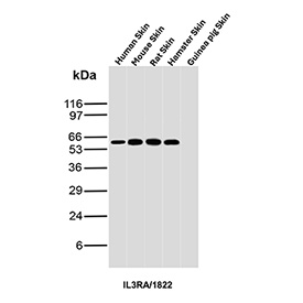 Western blot analysis of Interleukin-3 receptor alpha chain / IL3RA antibody (clone IL3RA/1822) in skin tissue lysates. Samples include human skin, mouse skin, rat skin, hamster skin, and guinea pig skin lysates. A major band is detected at an apparent molecular weight of ~60 kDa, consistent with glycosylated IL3RA, while the predicted molecular weight of the unglycosylated polypeptide is ~43 kDa.
