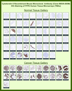 Immunohistochemistry analysis of recombinant Keratin 5 / KRT5 antibody (clone MSVA-605M) in FFPE human tissue microarrays. Representative normal and cancer tissue cores show brown chromogenic staining predominantly in basal epithelial cells and tumors with basal or squamous differentiation, while non-epithelial tissues remain largely negative, consistent with the known expression pattern of Keratin 5 in basal epithelial compartments and KRT5-positive carcinomas.