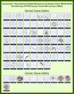 Immunohistochemistry analysis of Keratin 7 / KRT7 antibody (clone MSVA-607R) in FFPE human tissue microarrays. Normal and cancer tissue cores show cytoplasmic brown chromogenic staining in epithelial cells consistent with Keratin 7-positive glandular and ductal epithelium, while non-epithelial tissues show minimal staining, in agreement with known KRT7 expression patterns and Human Protein Atlas data.