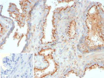 Immunohistochemistry analysis of LGALS9 / Galectin 9 antibody (clone LGALS9/7689) in human prostate tissue. Formalin-fixed, paraffin-embedded human prostate tissue was stained using LGALS9 / Galectin 9 antibody (clone LGALS9/7689). Heat-induced epitope retrieval was performed by heating tissue sections in 10mM Tris with 1mM EDTA, pH 9.0, for 45 minutes at 95oC followed by cooling at room temperature for 20 minutes prior to antibody incubation. Brown chromogenic signal is observed predominantly along the apical and cytoplasmic regions of glandular epithelial cells, while surrounding stromal elements show minimal staining. The inset image represents a secondary-only negative control using PBS in place of primary antibody, demonstrating absence of specific staining.
