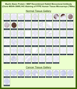 Myelin basic protein Rabbit Recombinant Monoclonal Antibody (MSVA-390R) tested on many normal and cancer tissues. The immunohistochemistry staining in these tissues aligns with the expression data in Human Protein Atlas. <br><br>Manual Protocol: Freshly cut sections should be used (less than 10 days between cutting and staining). Heat-induced antigen retrieval for 5 minutes in an autoclave at 121oC in pH 7.8 Target Retrieval Solution buffer. Apply the antibody at a dilution of 1:150 at 37oC for 60 minutes. Visualization of bound antibody by the EnVision Kit (Dako, Agilent) according to the manufacturer's directions.