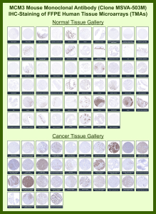 DNA replication licensing factor MCM3 Mouse Monoclonal Antibody (MSVA-503M) tested on many normal and cancer tissues. The immunohistochemistry staining in these tissues aligns with the expression data in Human Protein Atlas. <br><br>Manual Protocol: Freshly cut sections should be used (less than 10 days between cutting and staining). Heat-induced antigen retrieval for 5 minutes in an autoclave at 121oC in pH 7.8 Target Retrieval Solution buffer. Apply the antibody at a dilution of 1:150 at 37oC for 60 minutes. Visualization of bound antibody by the EnVision Kit (Dako, Agilent) according to the manufacturer's directions.