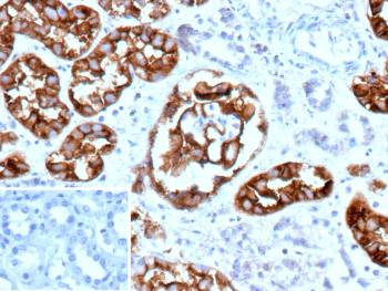 Immunohistochemistry of recombinant MME/Membrane metalloendopeptidase antibody (clone MME/12800R) in formalin-fixed, paraffin-embedded human kidney tissue shows strong membranous brown chromogenic staining in renal tubular epithelial cells, consistent with known CD10 expression in proximal tubules. Nuclei are counterstained blue. Inset: PBS used in place of primary antibody as a negative control shows no specific staining. Heat-induced epitope retrieval was performed by boiling tissue sections in 10mM Tris with 1mM EDTA, pH 9.0, for 45 minutes at 95oC followed by cooling at room temperature for 20 minutes.