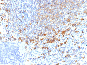 Immunohistochemistry analysis of Gelatinase B / MMP9 antibody (clone r15W2) in human spleen tissue. Formalin-fixed, paraffin-embedded human spleen section shows cytoplasmic brown chromogenic staining in scattered immune cells within the splenic parenchyma, consistent with MMP9 expression, while surrounding lymphoid cells display minimal staining and nuclei appear blue. The inset shows PBS used in place of primary antibody as a negative control with no specific staining observed. Heat-induced epitope retrieval was performed by heating tissue sections in 10 mM Tris with 1 mM EDTA, pH 9.0, for 45 minutes at 95oC followed by cooling at room temperature for 20 minutes prior to staining.