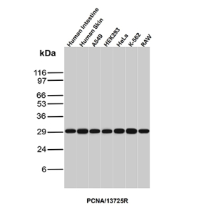 Western Blot Analysis of Human Intestine,Human Skin, A549, HEK293, HeLa, K-562 and Raw lysates using PCNA Recombinant Rabbit Monoclonal Antibody (PCNA/13725R).